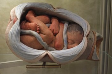 Bologna Poggi museum foetus model